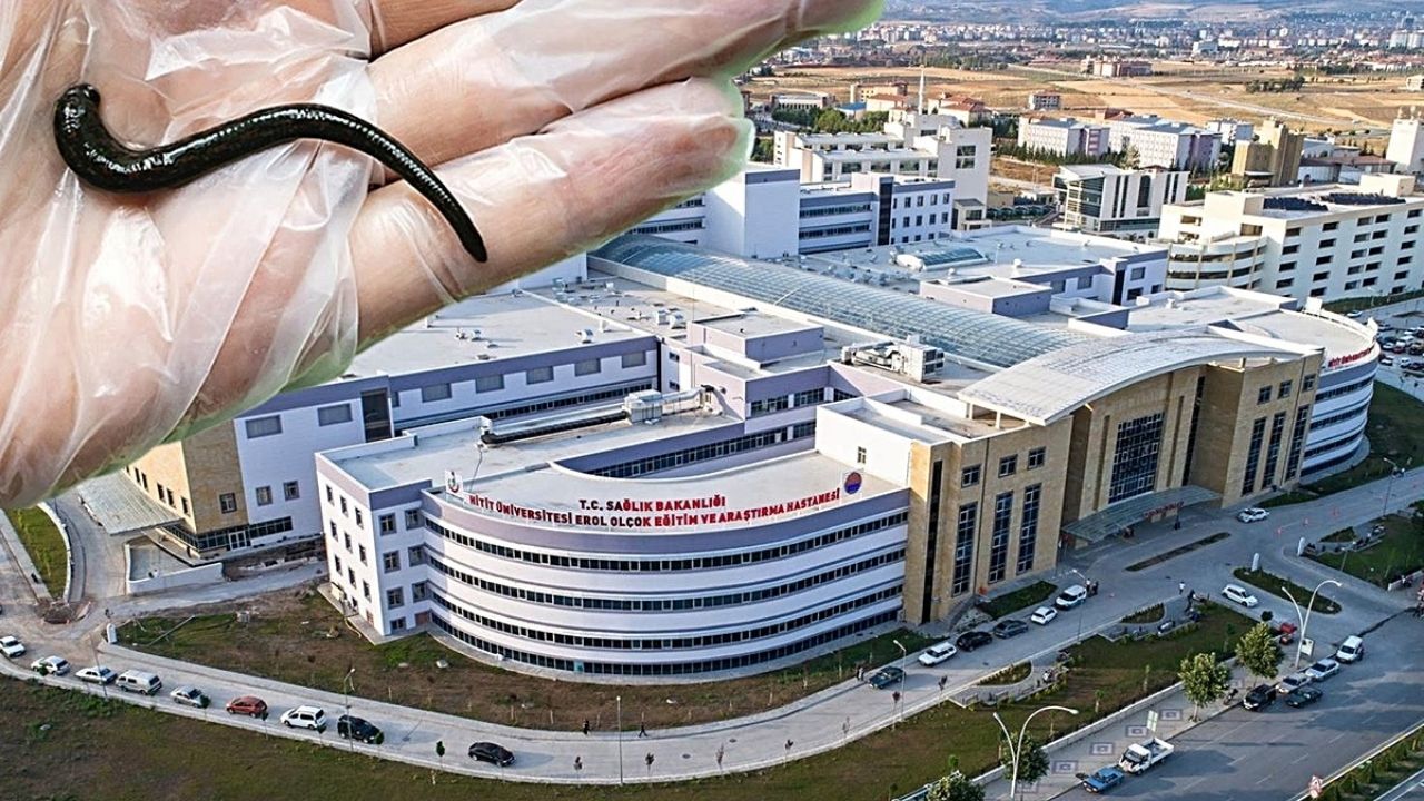 Boğaz Ağrısıyla Hastaneye Gitti, Ses Tellerinin Ardında Sülük Çıktı