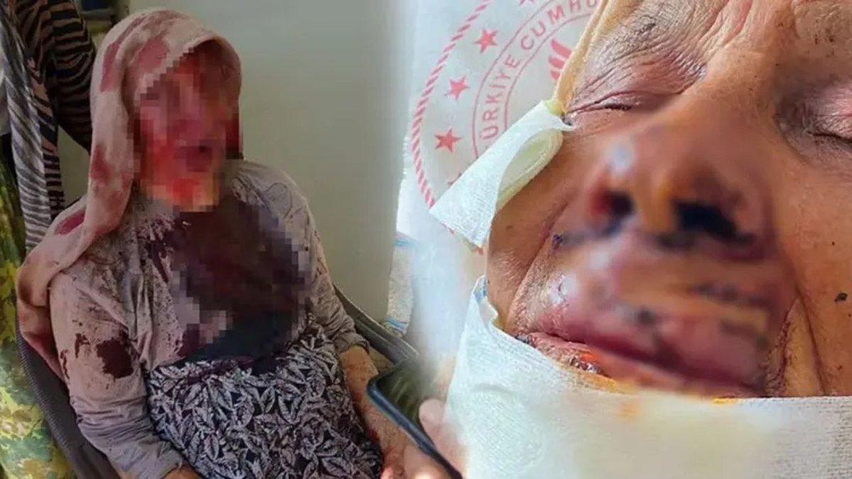 Şanlıurfa’da Dehşet Anları: 85 Yaşındaki Annesini Sopayla Döven Şüpheli Tutuklandı