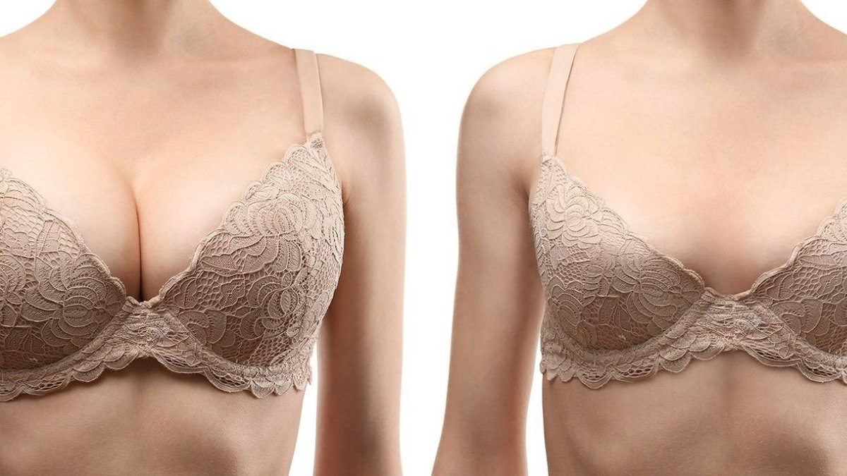 Kadınlarda Meme Küçültme Operasyonu: Faydaları,
